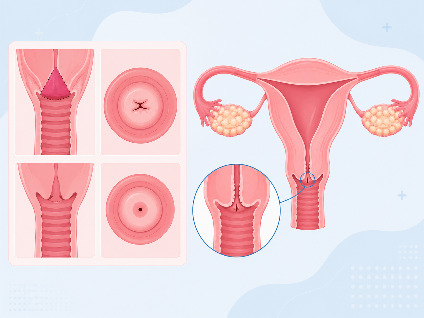 Per Vaginal Examination in Pregnancy: Why It Is Done During the 8th Month Per Vaginal Examination in Pregnancy: Why It Is Done During the 8th Month
