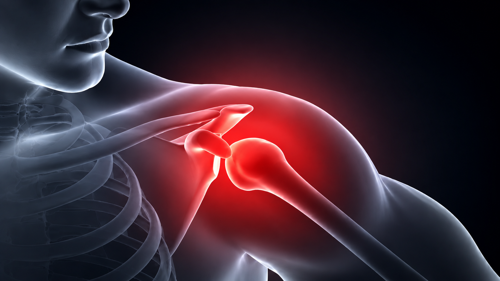 Shoulder Pain That Won't Go Away? Here's What Your Shoulder Could Be Telling You Shoulder Pain That Won't Go Away? Here's What Your Shoulder Could Be Telling You